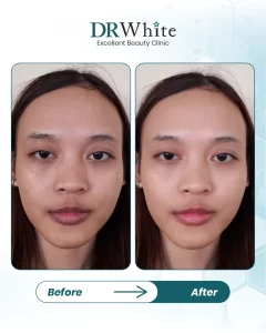 4 LANDING PAGE DUAL GLOWING LASER_11zon